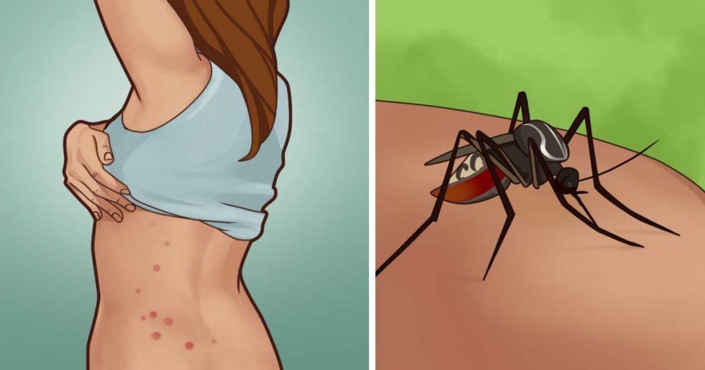Modi facili per liberarsi delle zanzare senza usare Deet o lozioni alla calamina